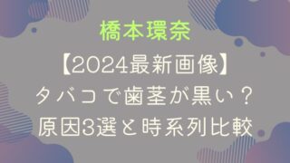 【2024最新画像】橋本環奈はタバコで歯茎が黒い？原因3選と時系列比較