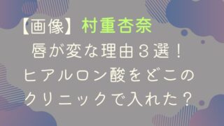 【画像】村重杏奈の唇が変な理由３選！ヒアルロン酸をどこのクリニックで入れた？